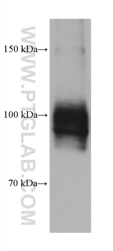 ATP1A1/2