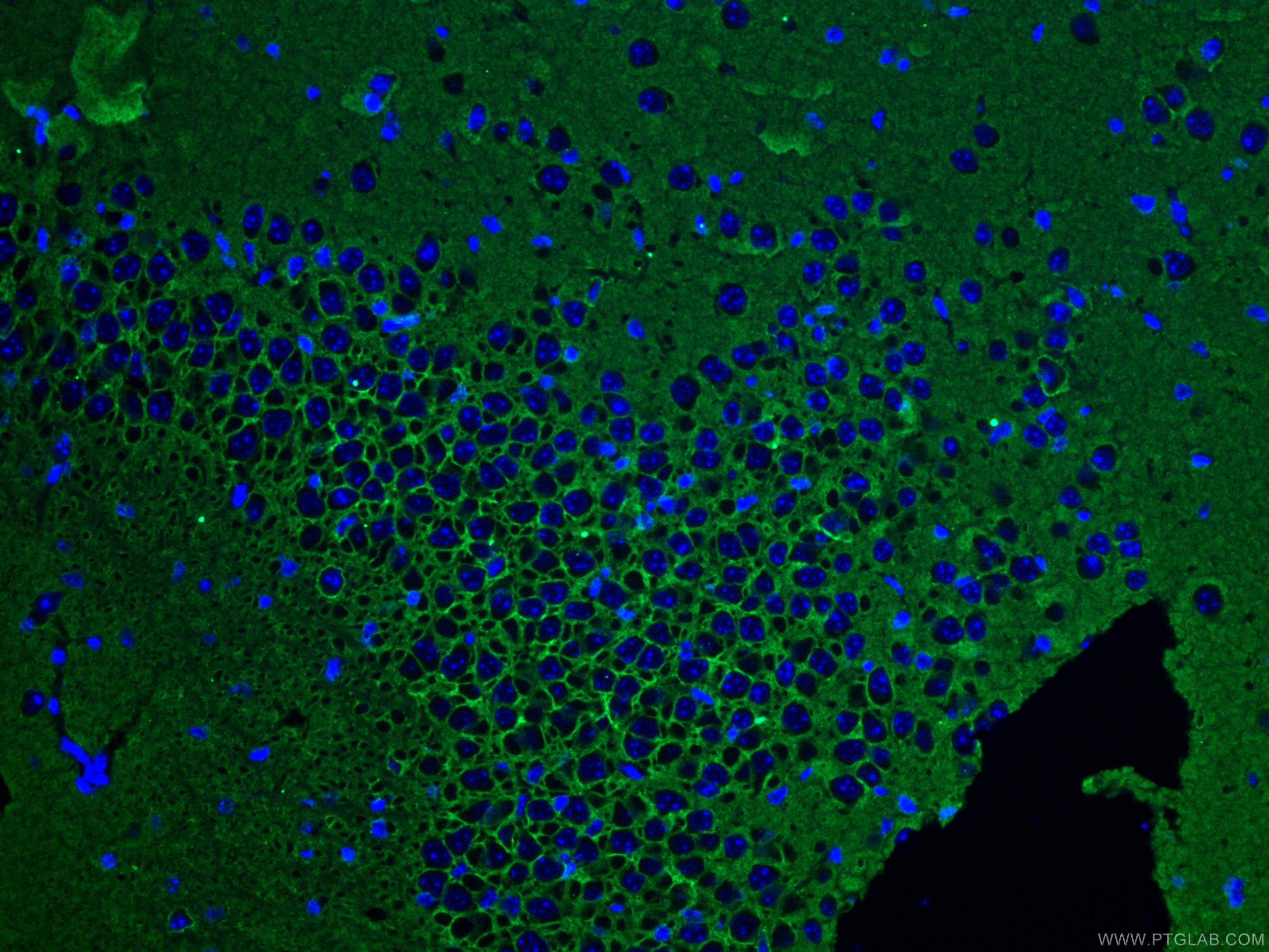 IF Staining of mouse brain using 10868-1-AP