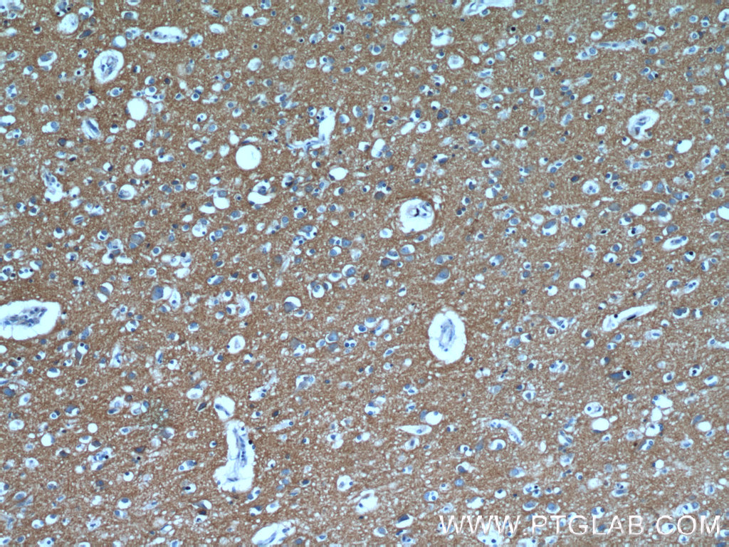 IHC staining of human brain using 15192-1-AP