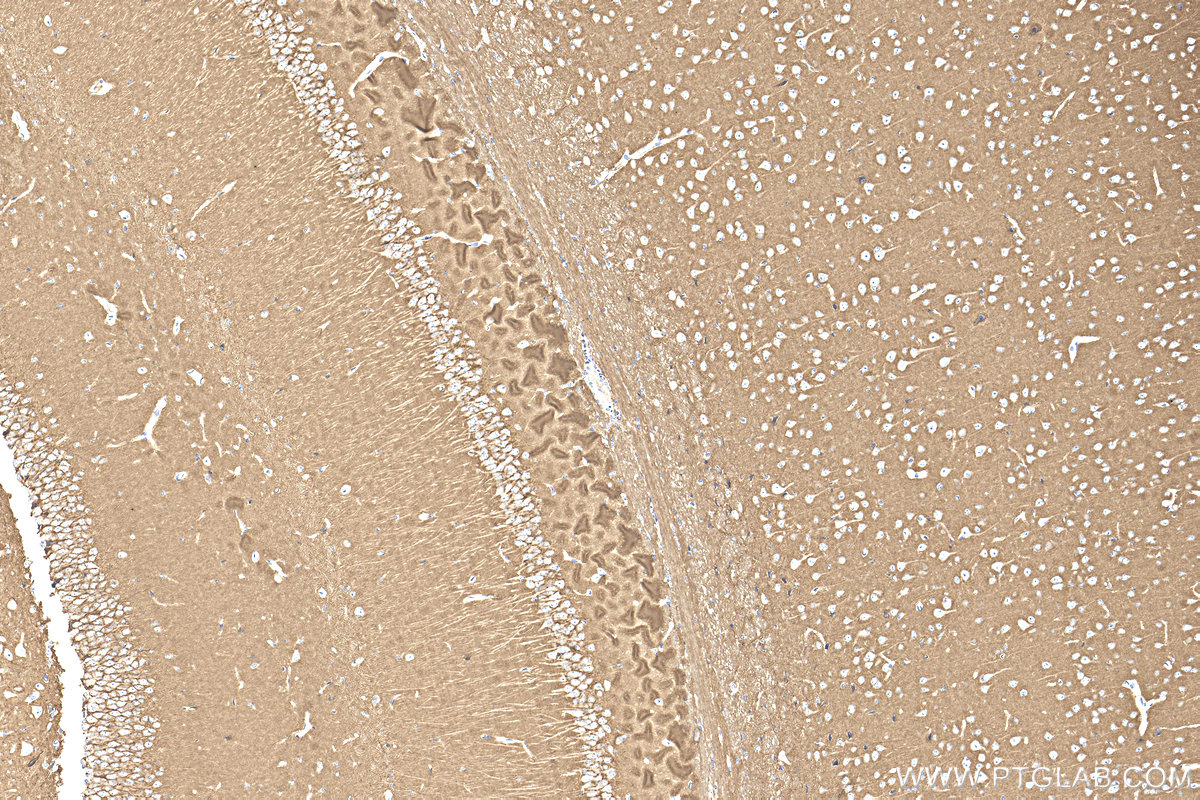 IHC staining of mouse brain using 32764-1-AP IHC staining of mouse brain using 32764-1-AP