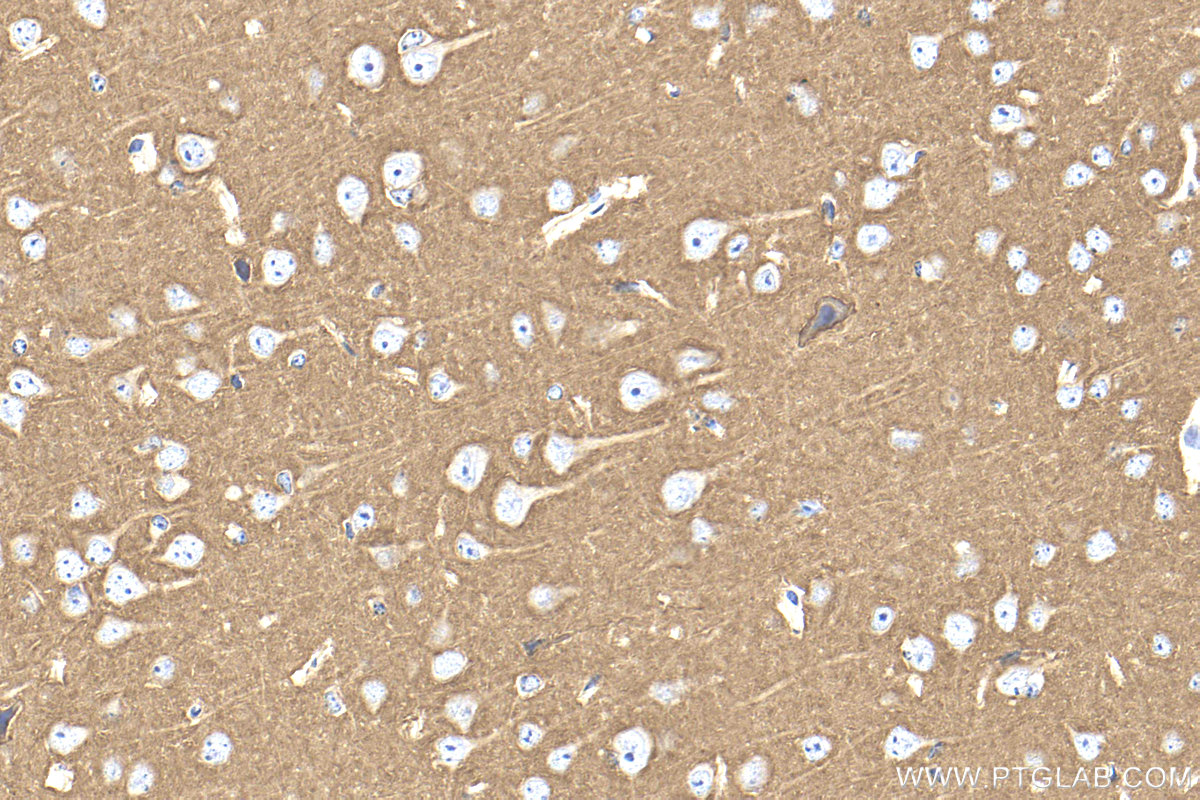 IHC staining of mouse brain using 32764-1-AP IHC staining of mouse brain using 32764-1-AP