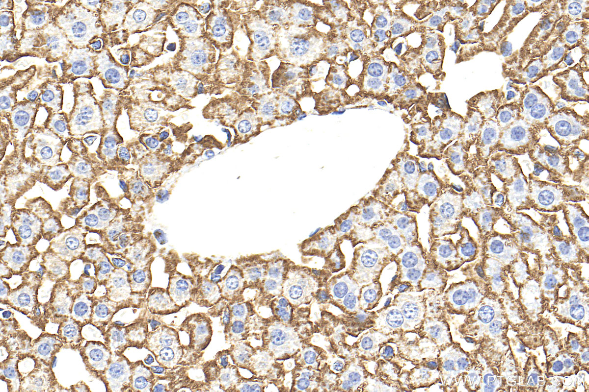 IHC staining of mouse liver using 32764-1-AP IHC staining of mouse liver using 32764-1-AP
