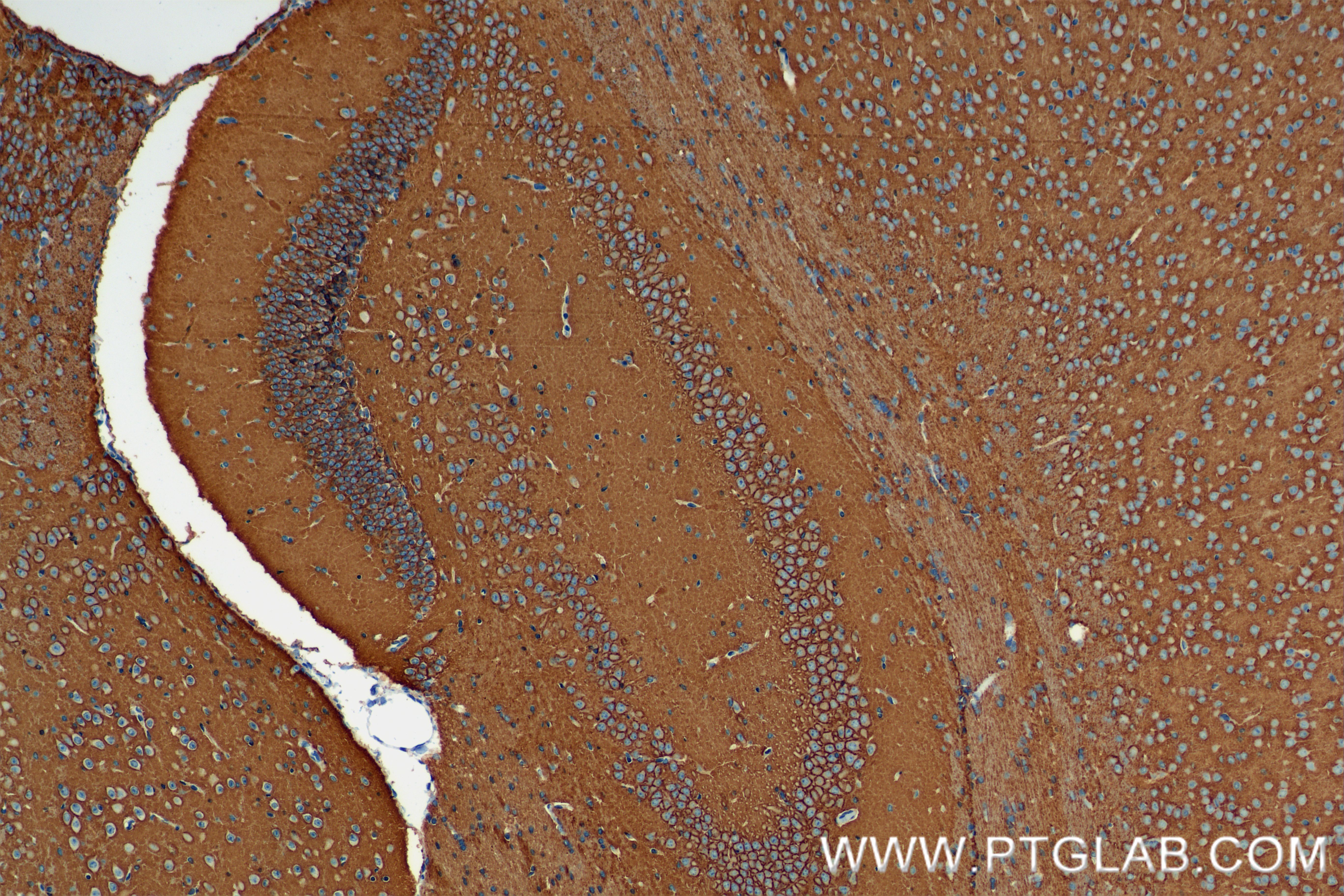 IHC staining of mouse brain using 84707-5-RR