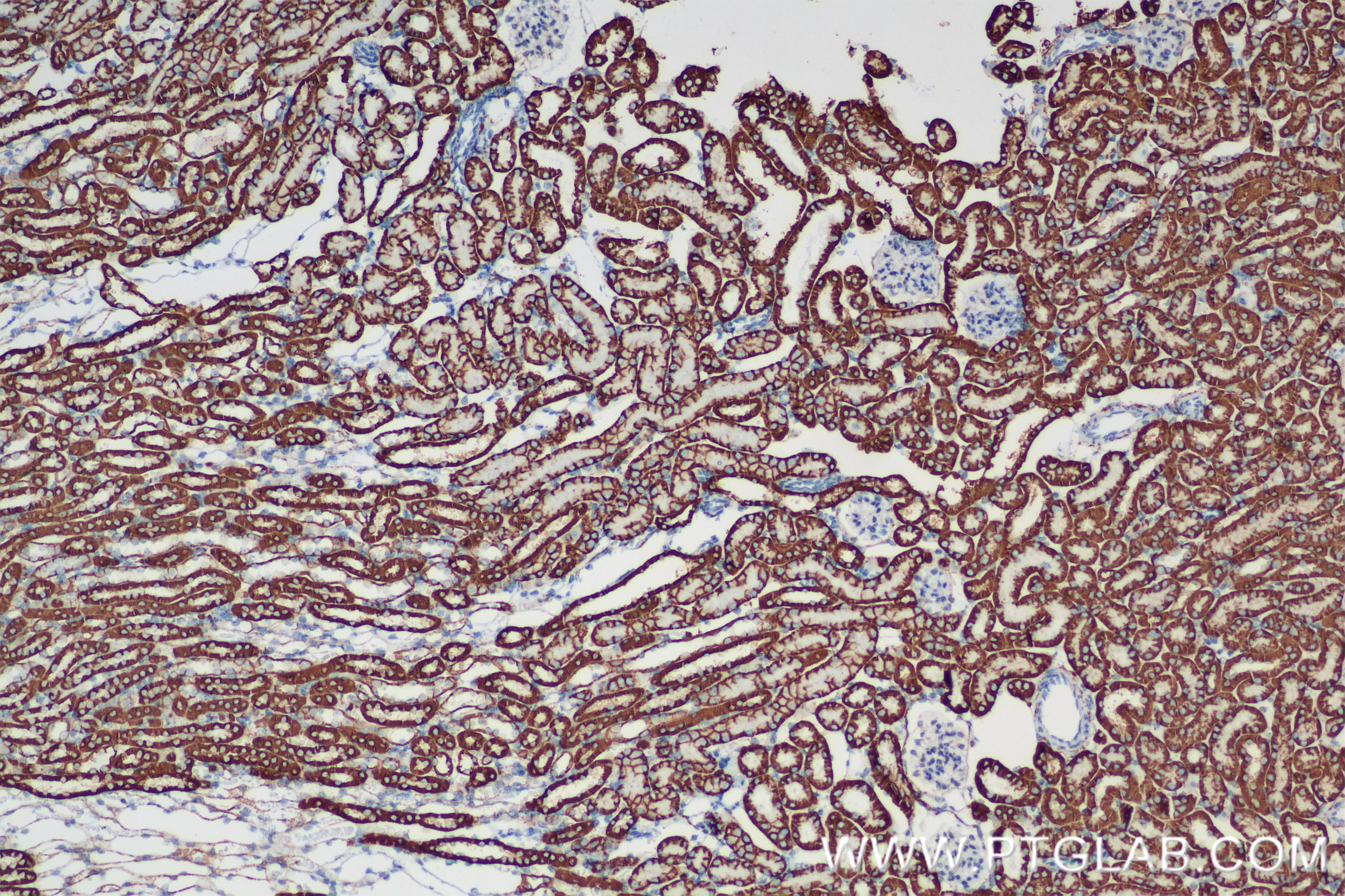 IHC staining of mouse kidney using 84707-5-RR