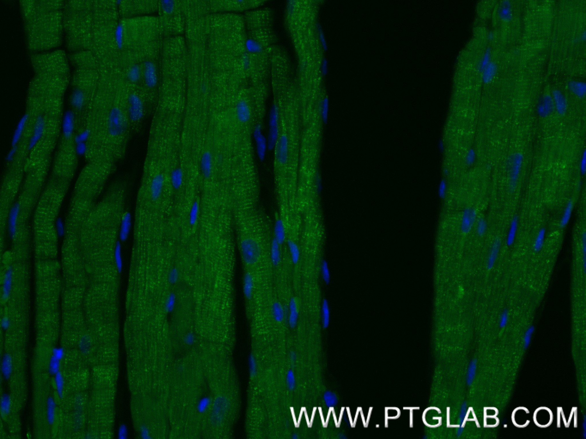 IF Staining of mouse heart using 85916-1-RR (same clone as 85916-1-PBS) IF Staining of mouse heart using 85916-1-RR (same clone as 85916-1-PBS)