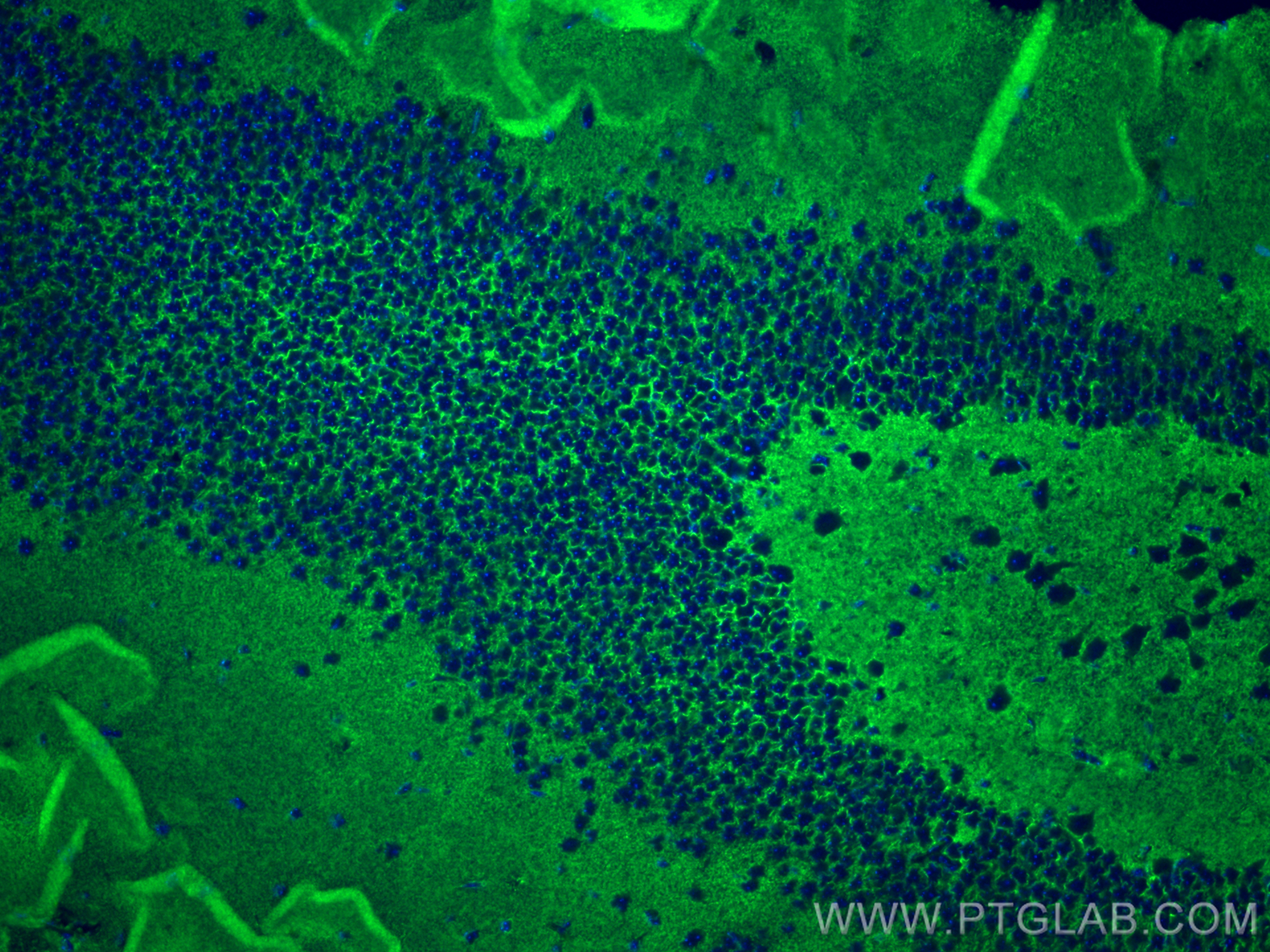 IF Staining of mouse brain using 22338-1-AP