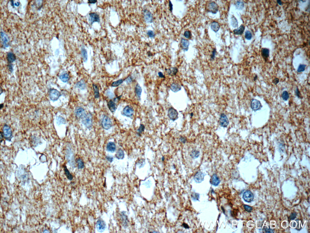 ATP1B2 Polyclonal antibody