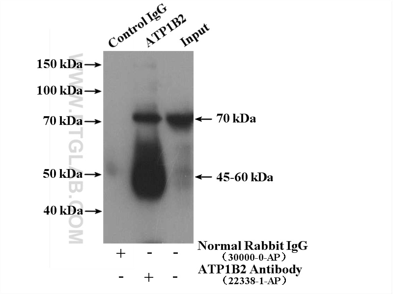 IP experiment of mouse skeletal muscle using 22338-1-AP