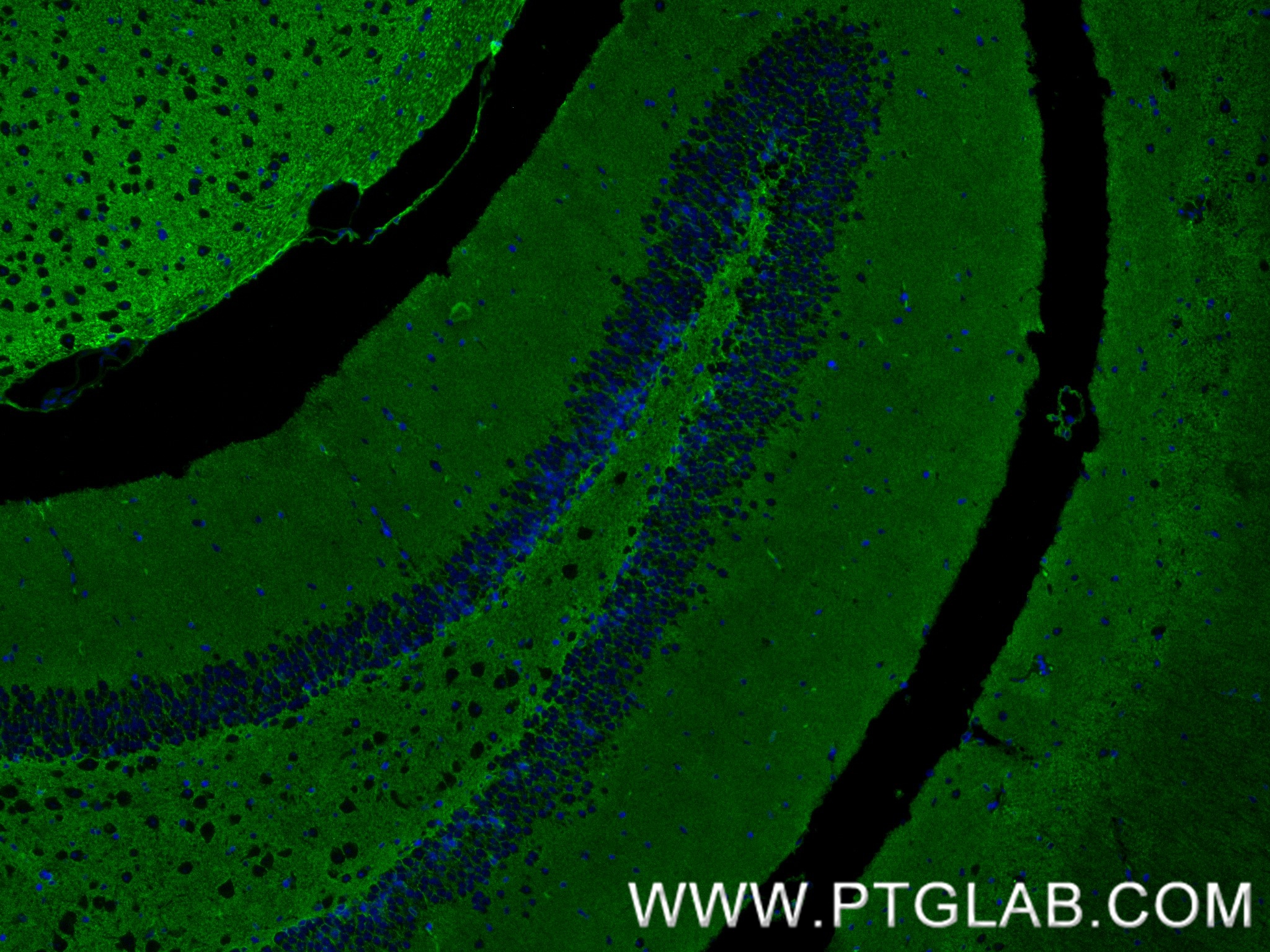 IF Staining of mouse brain using 88109-1-RR (same clone as 88109-1-PBS)