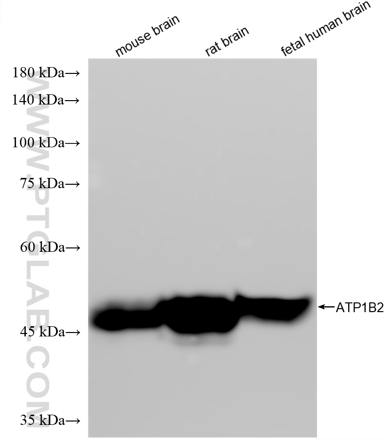 WB analysis using 88109-1-RR (same clone as 88109-1-PBS)