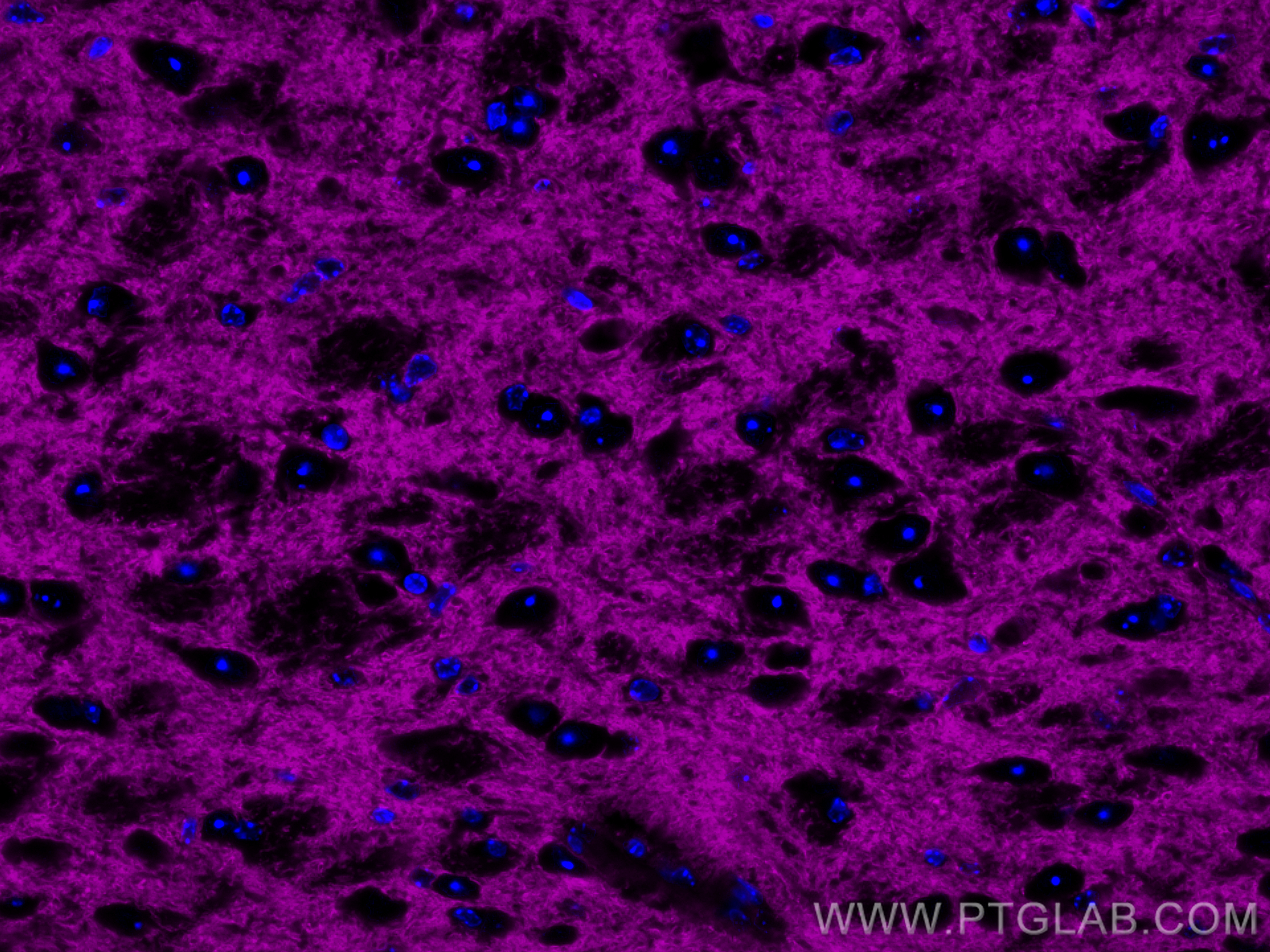 IF Staining of mouse brain using CL647-22338