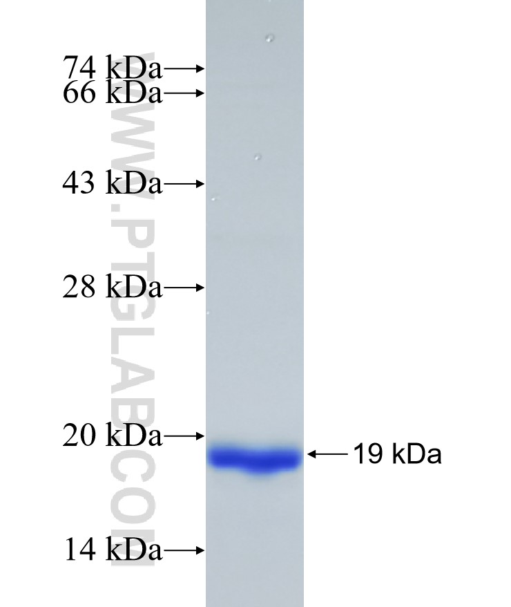ATP1B2 fusion protein Ag18023 SDS-PAGE ATP1B2 fusion protein Ag18023 SDS-PAGE
