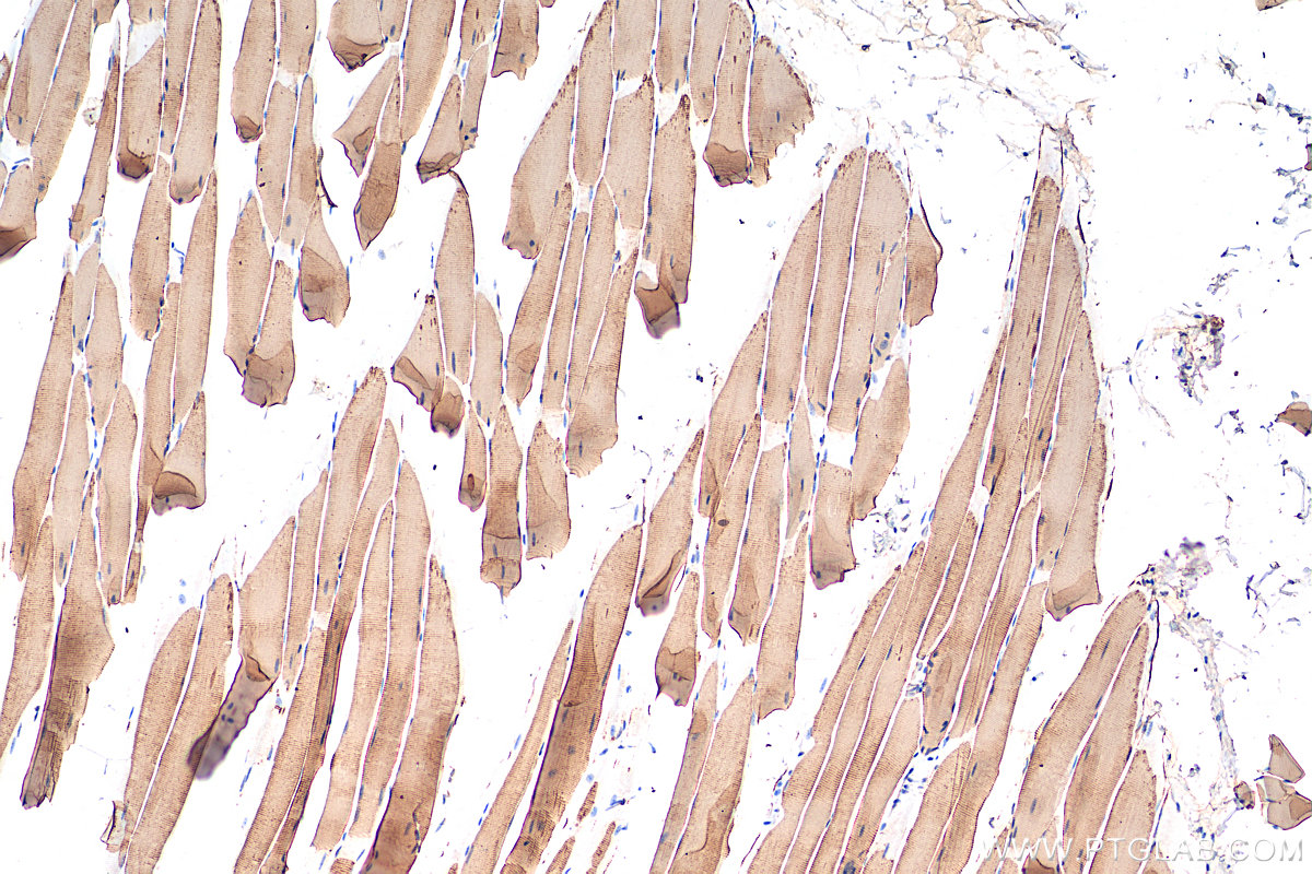 IHC staining of mouse skeletal muscle using 22361-1-AP