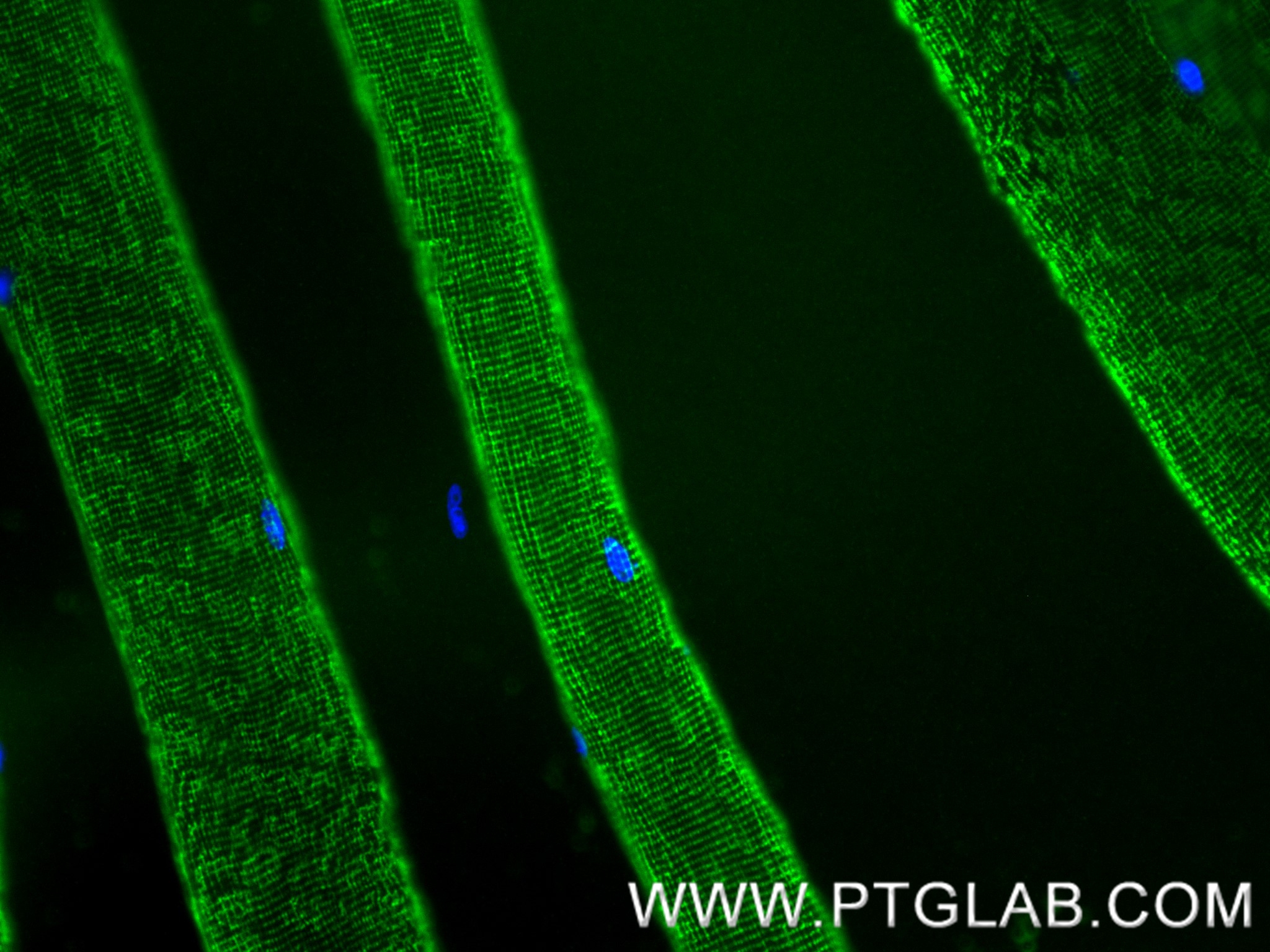 IF Staining of mouse skeletal muscle using 84213-5-RR