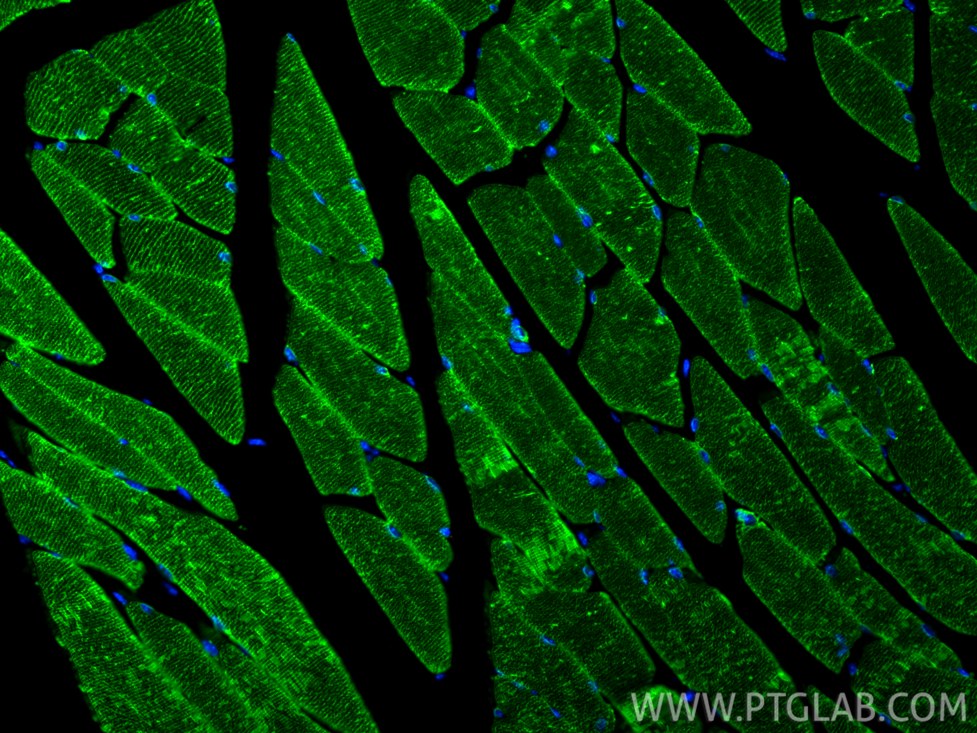 Immunofluorescent analysis of (4% PFA) fixed paraffin-embedded mouse skeletal muscle tissue using ATP2A1 antibody (84213-5-RR, Clone: 241500D12 ) at dilution of 1:400 and CoraLite®488-Conjugated Goat Anti-Rabbit IgG(H+L) (<a class='green' href='/productredirect?CatalogNo=SA00013-2' target='_blank'>SA00013-2</a>). Heat mediated antigen retrieval with Tris-EDTA buffer (pH 9.0). IF Staining of mouse skeletal muscle using 84213-5-RR