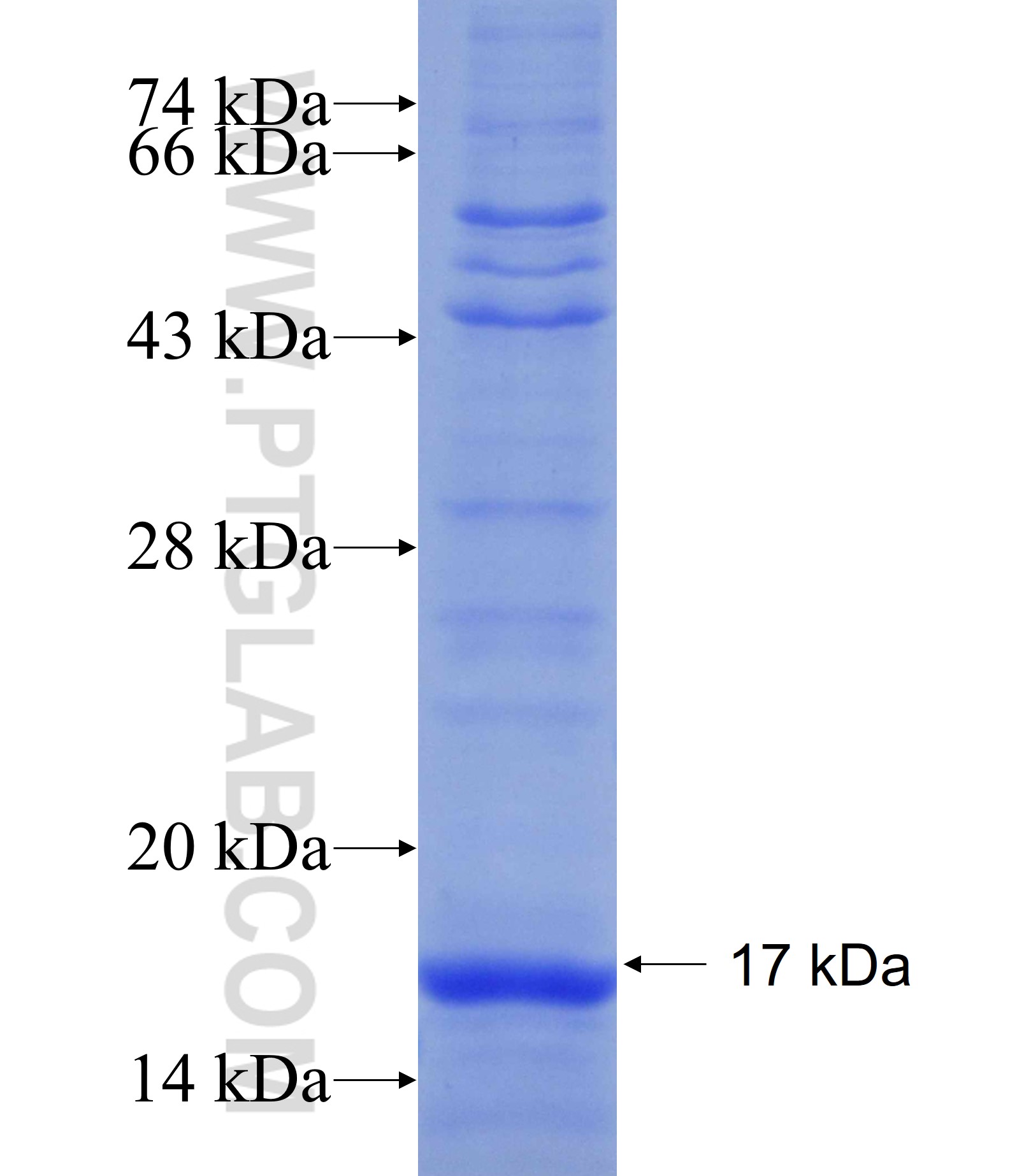 ATP2A1 fusion protein Ag18184 SDS-PAGE