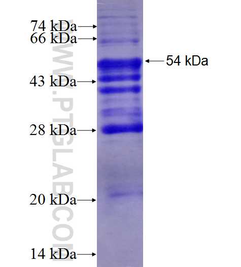 ATP2A3 fusion protein Ag4706 SDS-PAGE ATP2A3 fusion protein Ag4706 SDS-PAGE