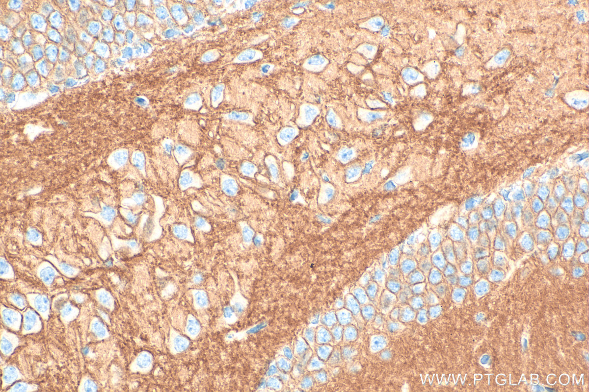 Immunohistochemical analysis of paraffin-embedded mouse brain tissue slide using 31692-1-AP (ATP2B3/PMCA3 antibody) at dilution of 1:1000 (under 40x lens). Heat mediated antigen retrieval with Tris-EDTA buffer (pH 9.0). IHC staining of mouse brain using 31692-1-AP