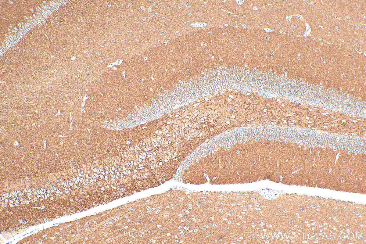 Immunohistochemical analysis of paraffin-embedded mouse brain tissue slide using 31692-1-AP (ATP2B3/PMCA3 antibody) at dilution of 1:1000 (under 10x lens). Heat mediated antigen retrieval with Tris-EDTA buffer (pH 9.0). IHC staining of mouse brain using 31692-1-AP