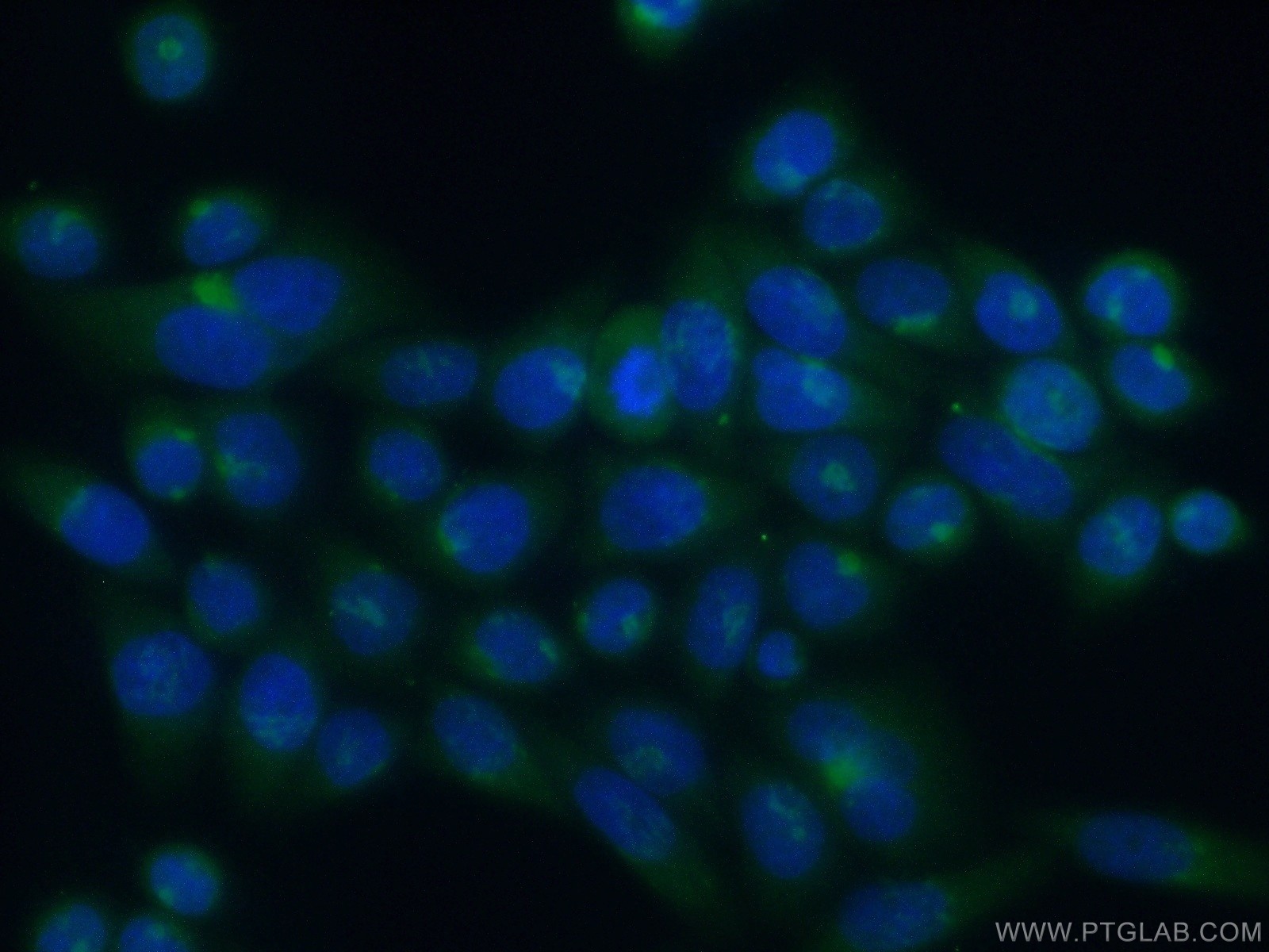 IF Staining of HeLa using 13310-1-AP