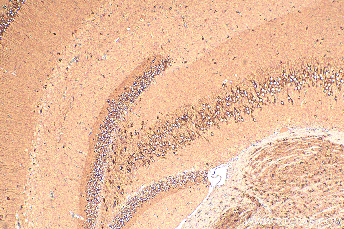 IHC staining of mouse brain using 13310-1-AP