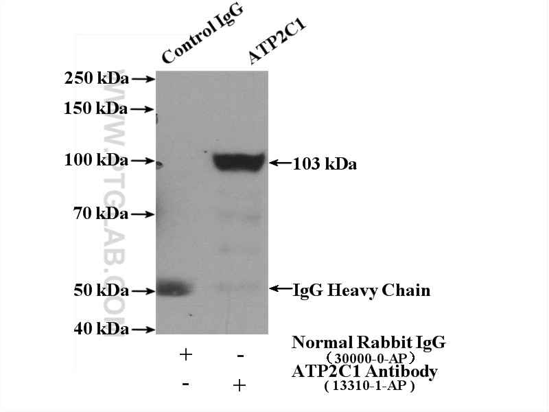 IP experiment of mouse kidney using 13310-1-AP
