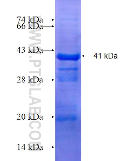 ATP2C1 fusion protein Ag14450 SDS-PAGE