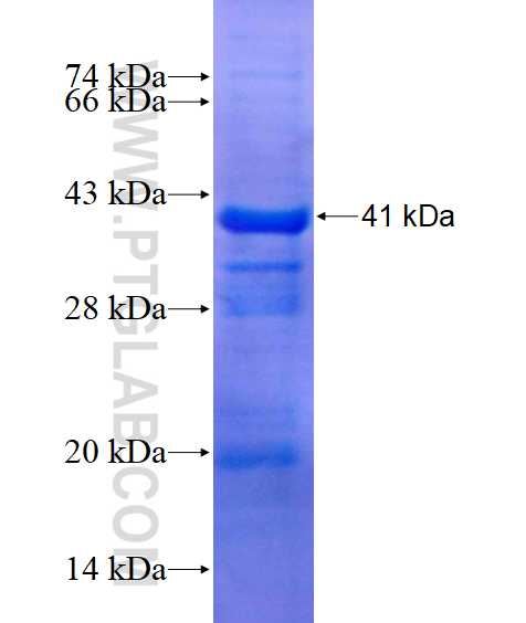 ATP2C1 fusion protein Ag14450 SDS-PAGE ATP2C1 fusion protein Ag14450 SDS-PAGE