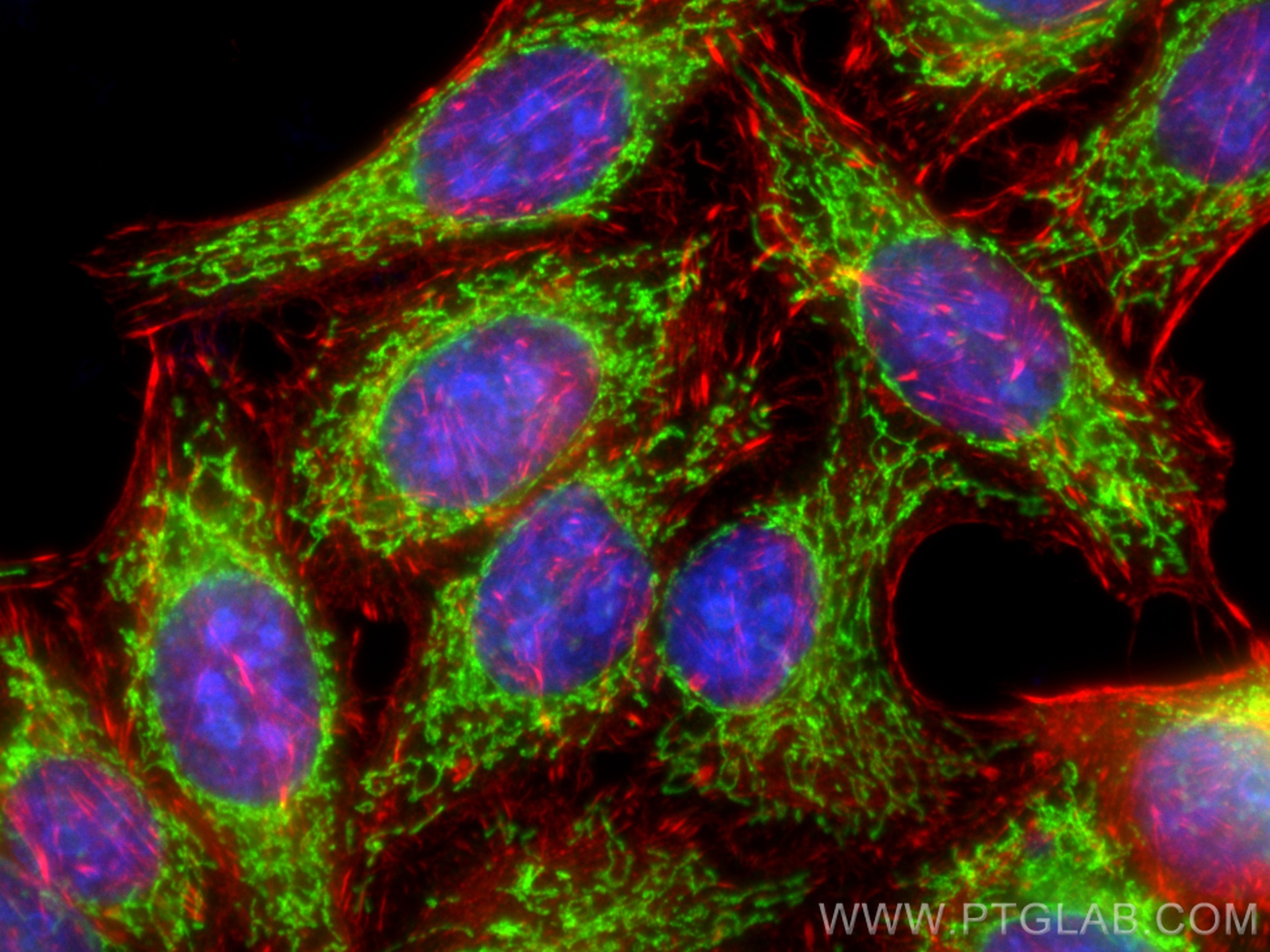 IF Staining of HepG2 using 14676-1-AP