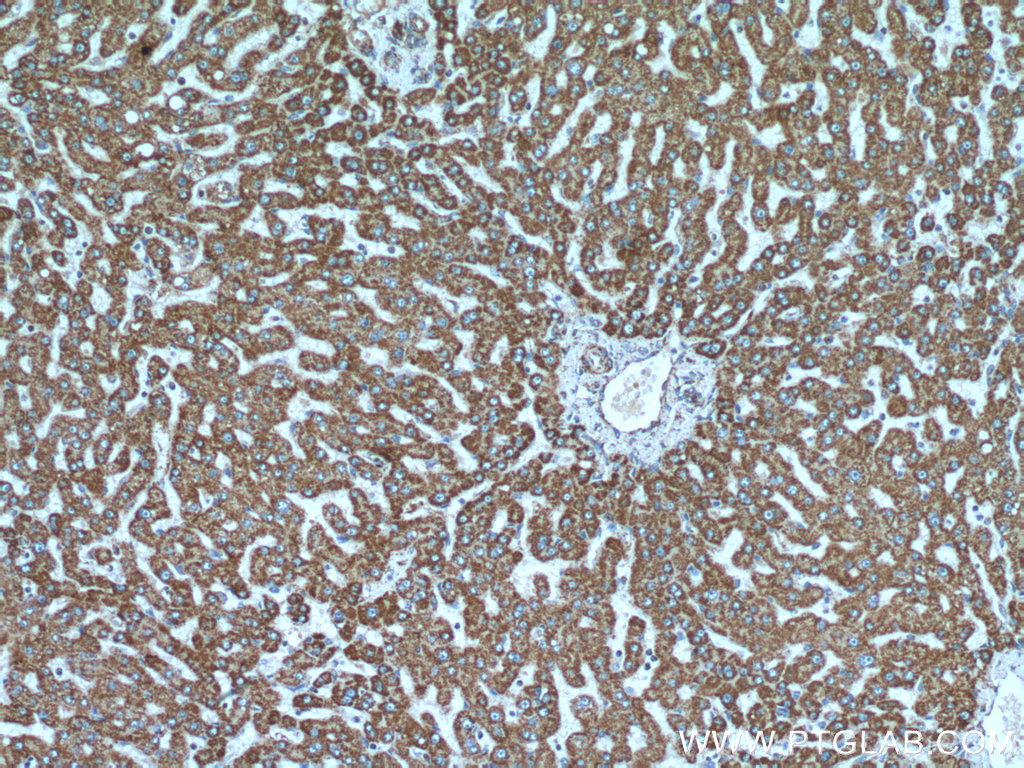 IHC staining of human liver using 14676-1-AP