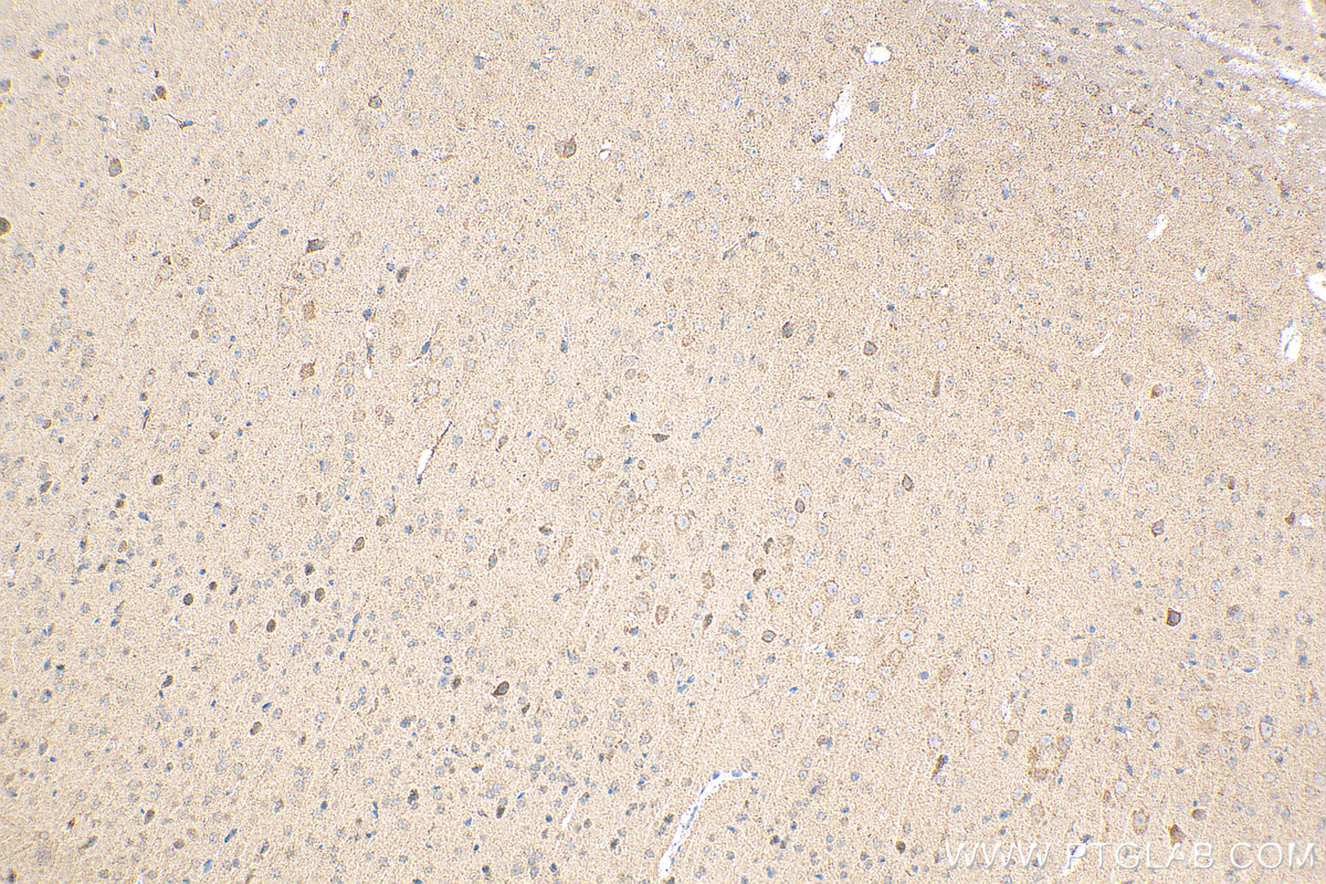 IHC staining of mouse brain using 14676-1-AP