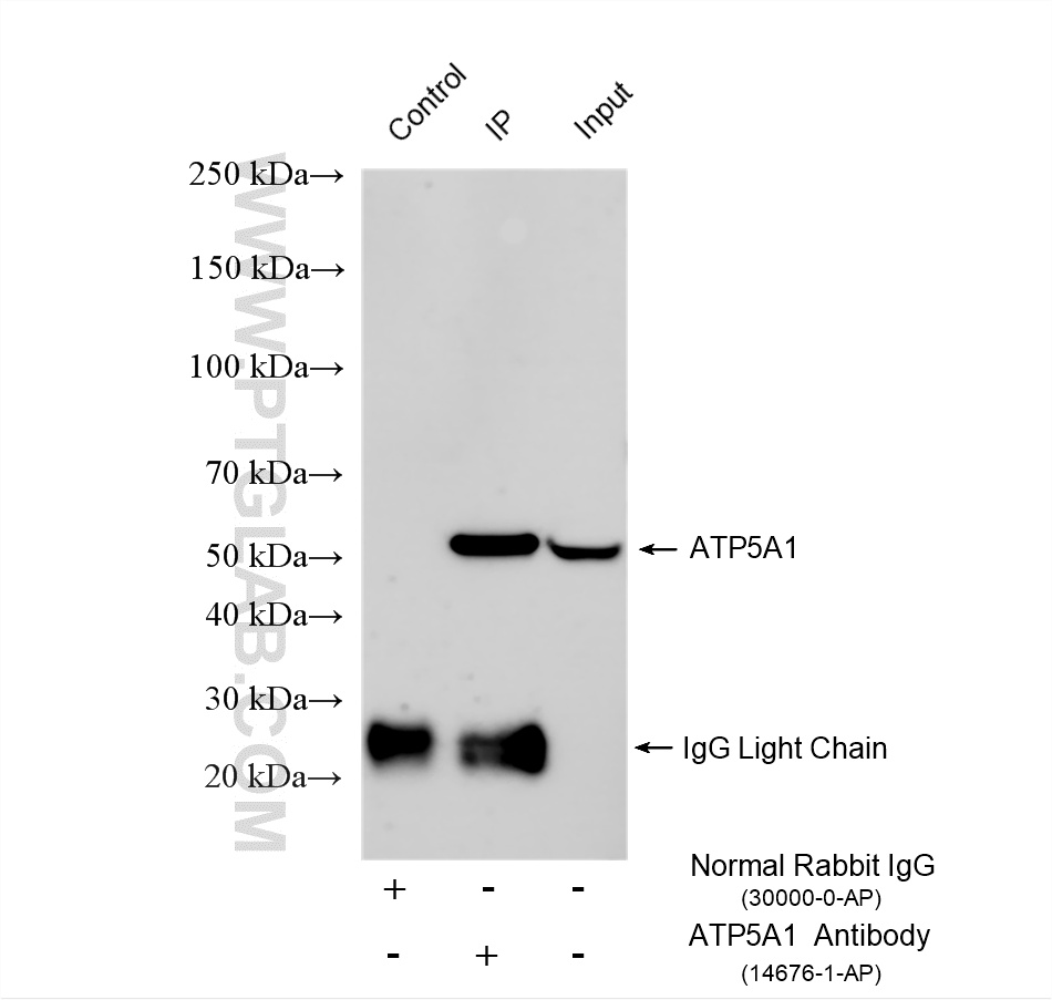 IP experiment of HeLa using 14676-1-AP