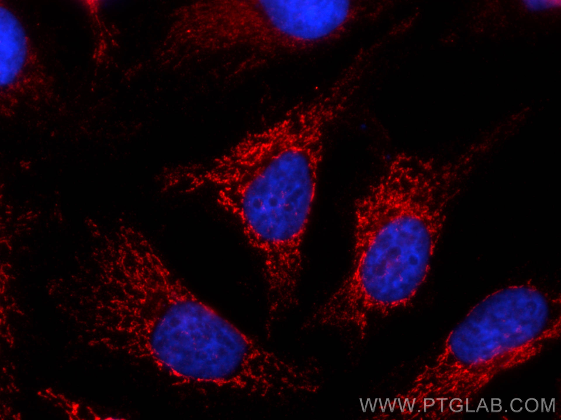 IF Staining of HeLa using 66037-1-Ig