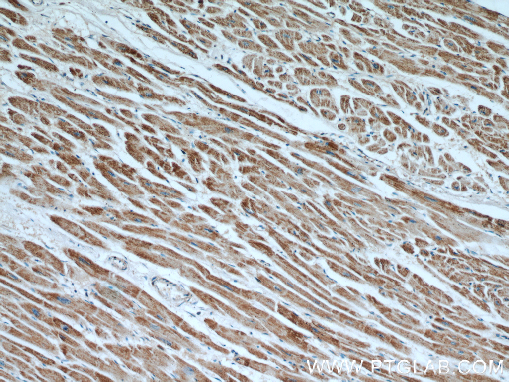 IHC staining of human heart using 66037-1-Ig (same clone as 66037-1-PBS)