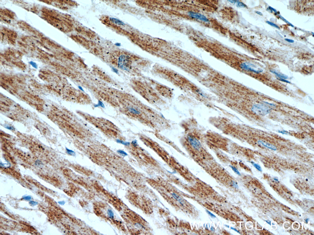 IHC staining of human heart using 66037-1-Ig (same clone as 66037-1-PBS)