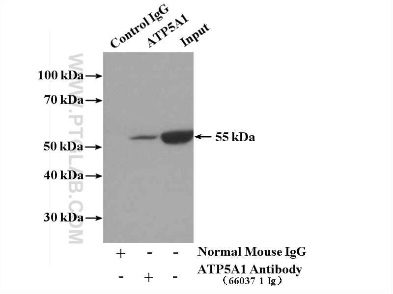 IP experiment of mouse heart using 66037-1-Ig (same clone as 66037-1-PBS)