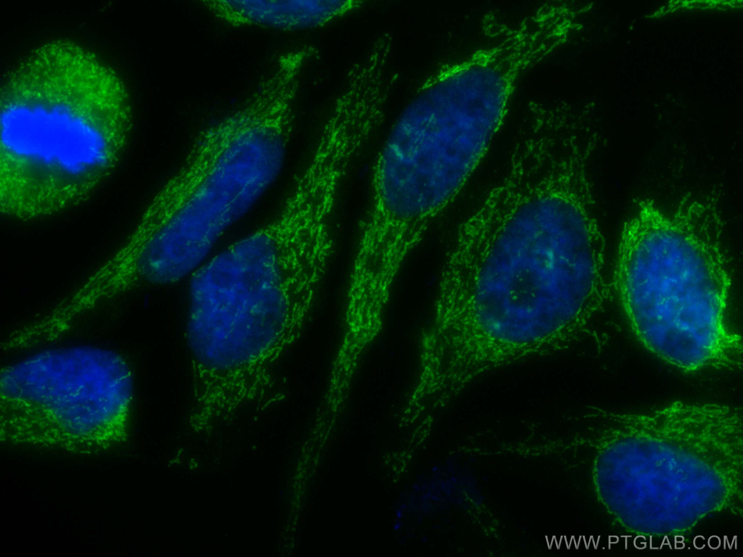 IF Staining of HeLa using CL488-82288