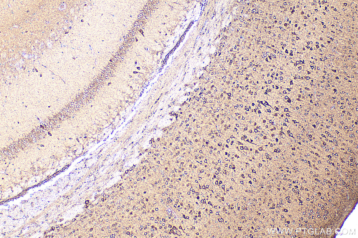 IHC staining of mouse brain using RMX00023