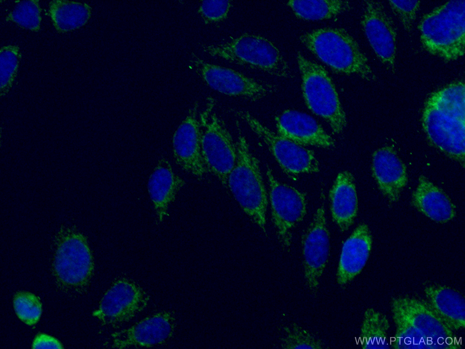 ATP5C1