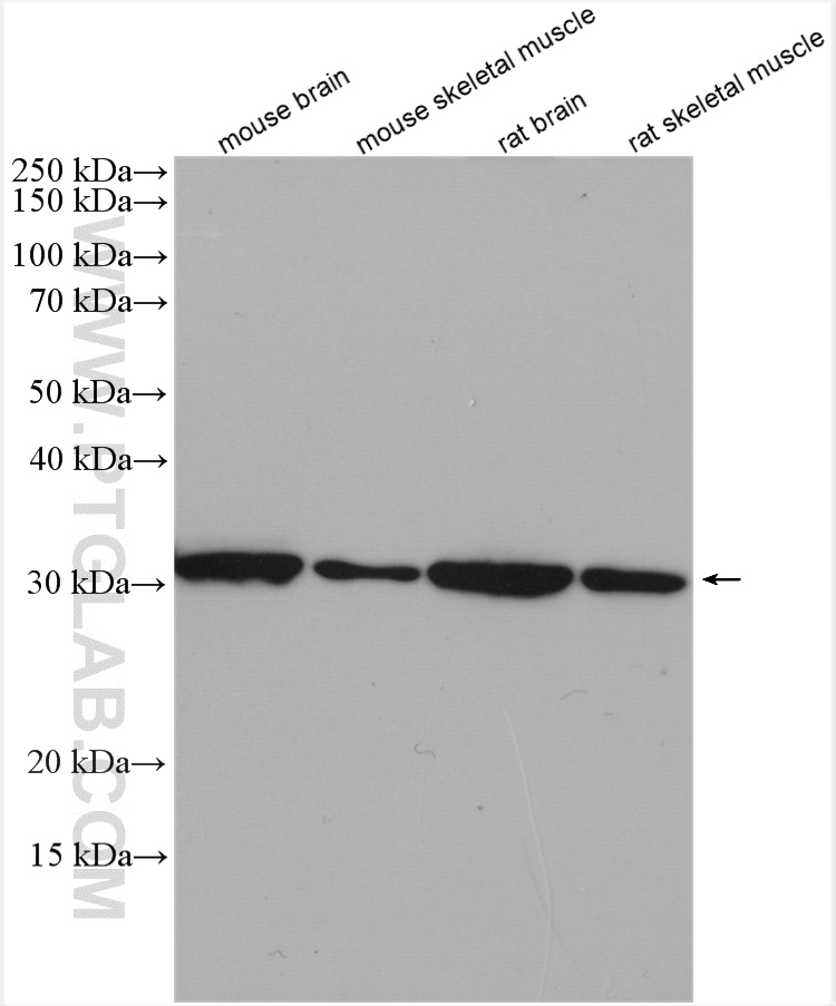 WB analysis using 10910-1-AP