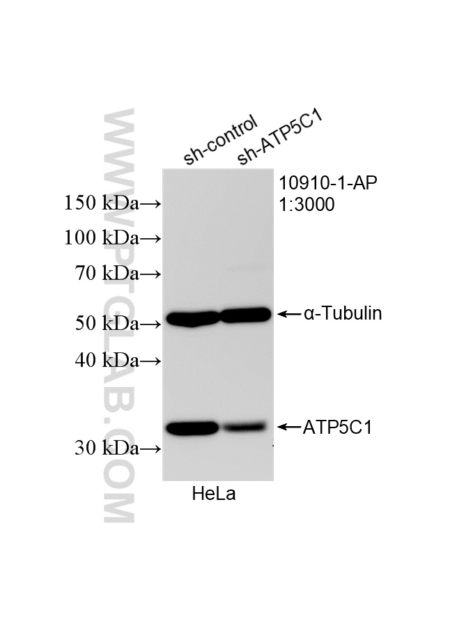 WB analysis of HeLa using 10910-1-AP WB analysis of HeLa using 10910-1-AP