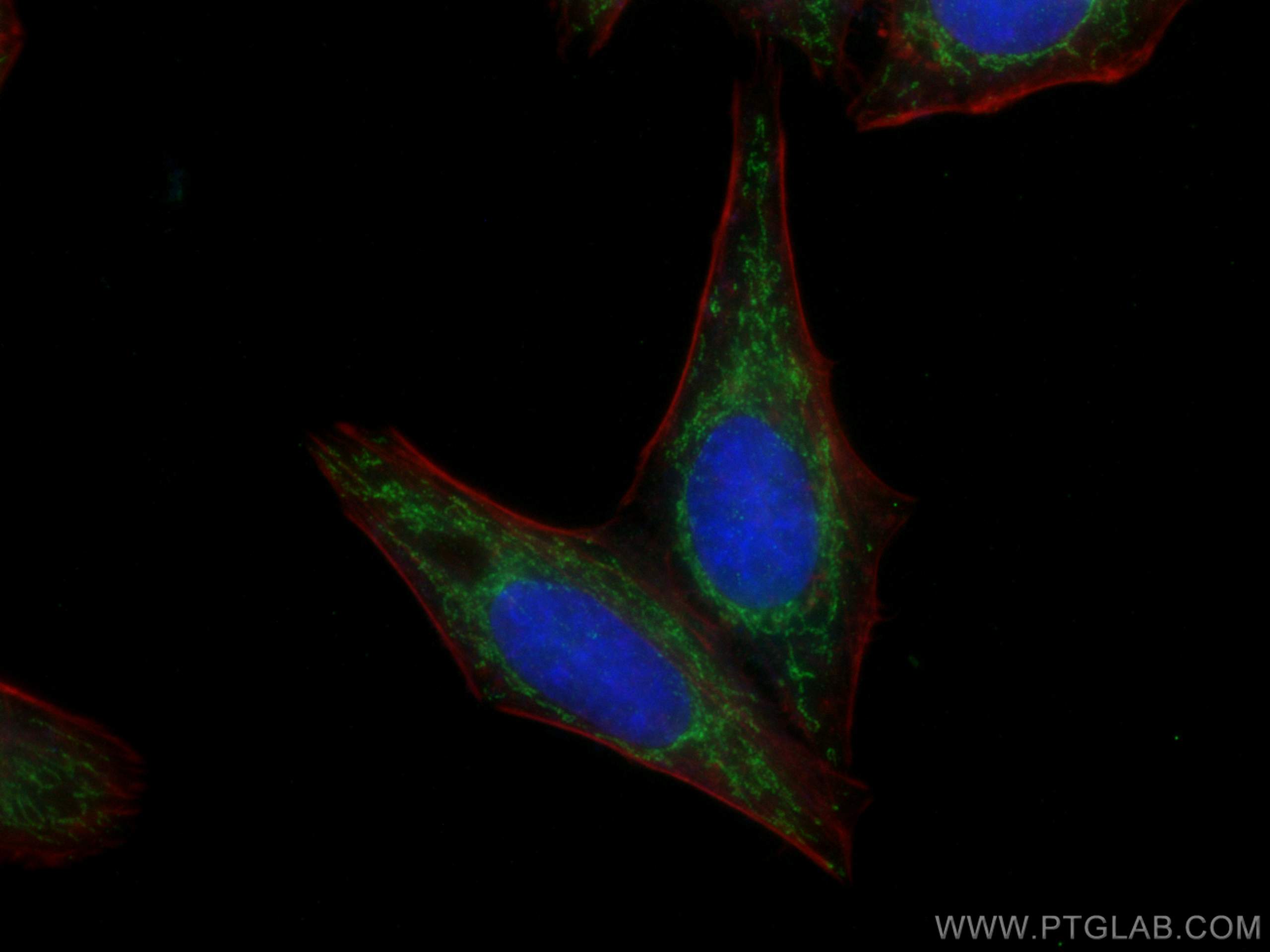 IF Staining of HepG2 using 60284-1-Ig