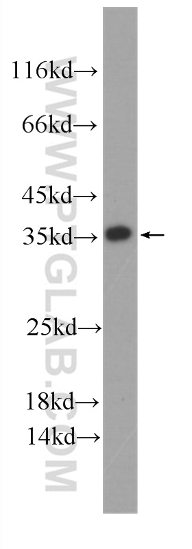 ATP5C1