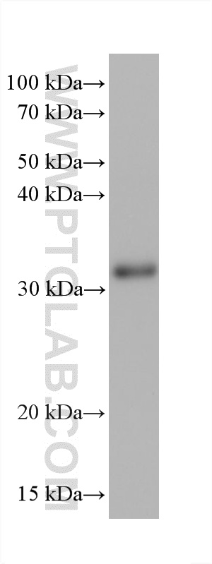 WB analysis of Caki-1 using 60284-1-Ig