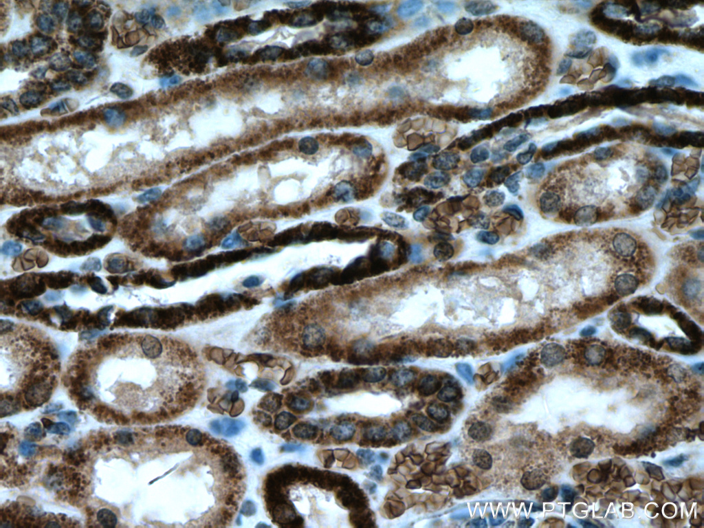 IHC staining of human kidney using 66673-1-Ig
