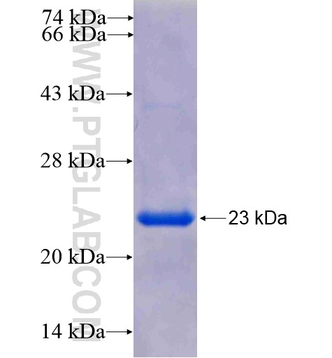 ATP5D fusion protein Ag7016 SDS-PAGE