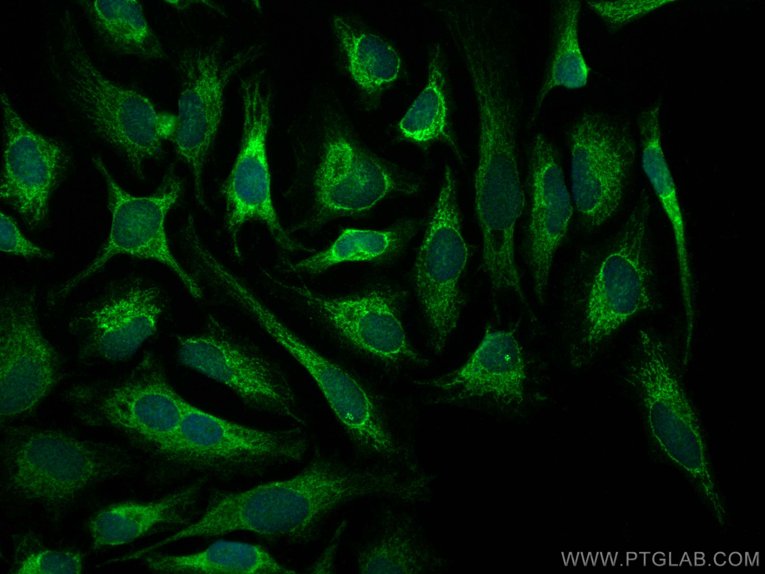 IF Staining of HeLa using 15408-1-AP