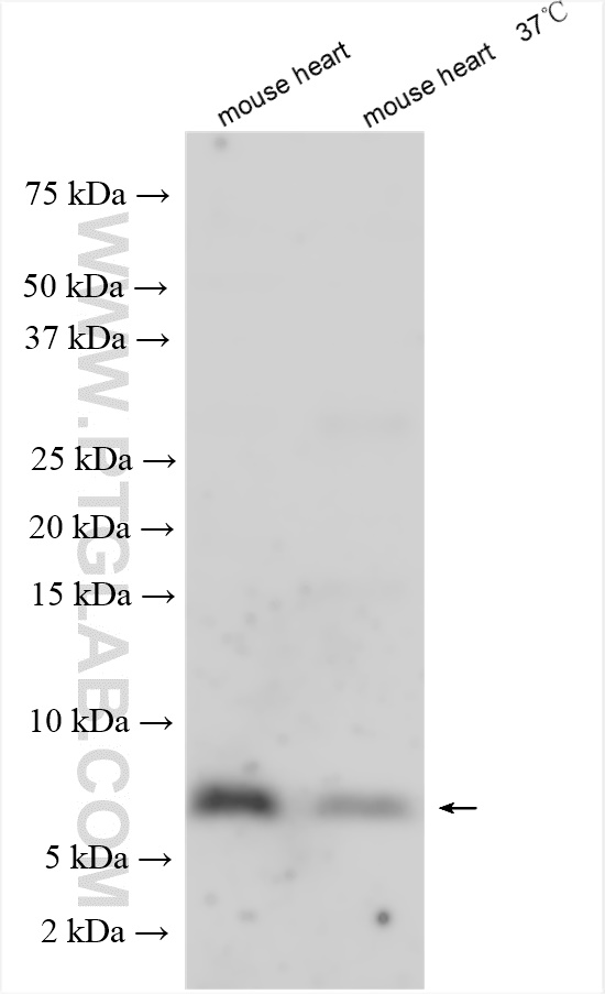 ATP5E