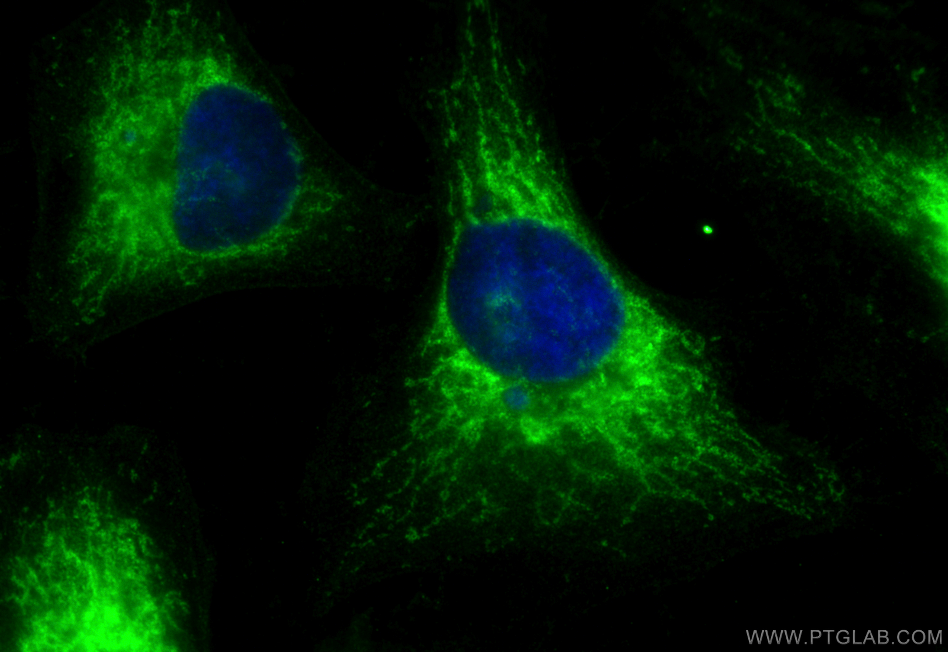 IF Staining of HeLa using 15999-1-AP