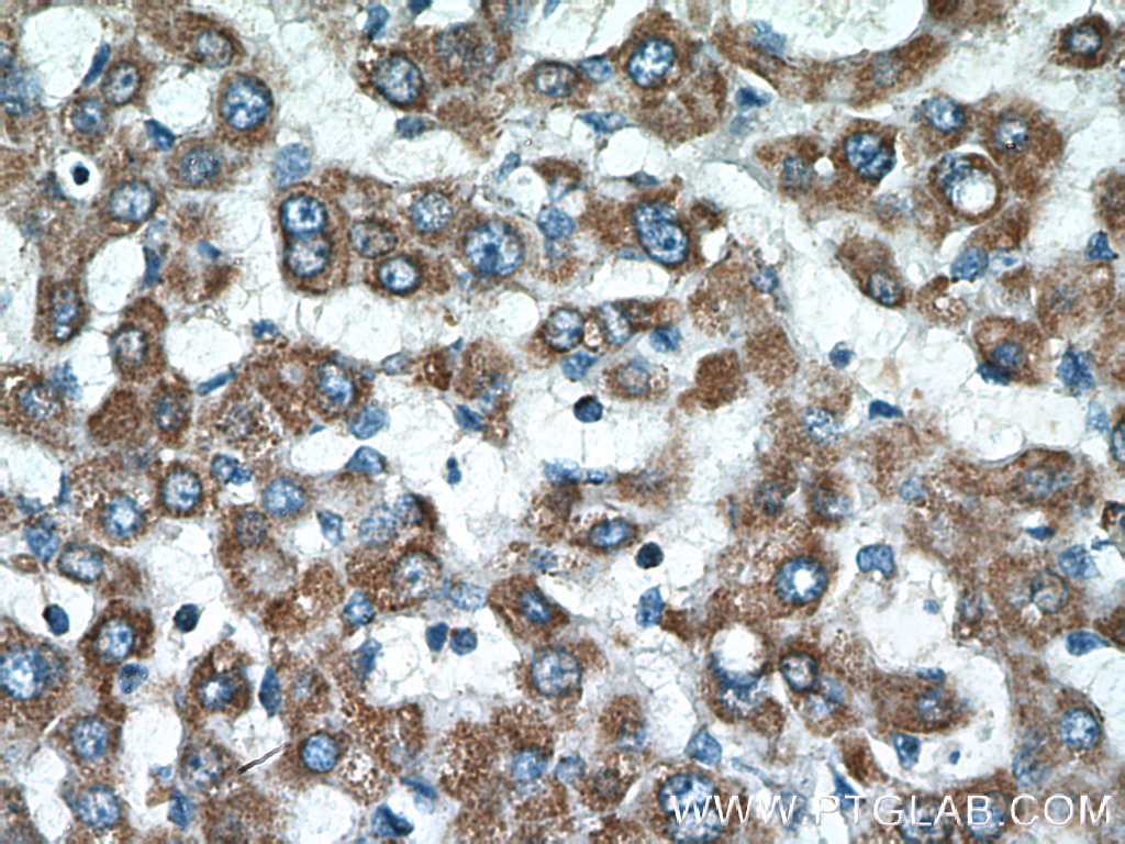 IHC staining of human liver using 15999-1-AP